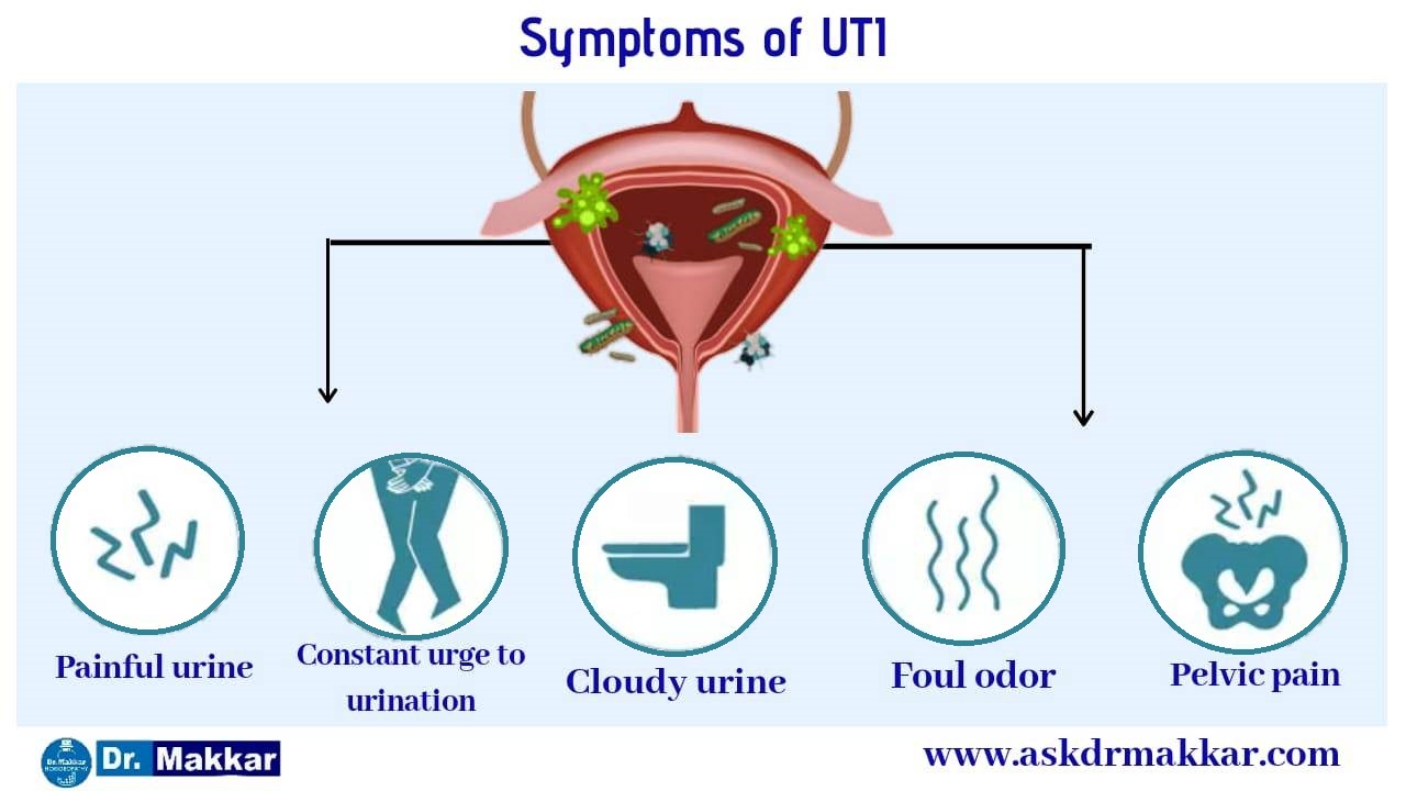 Urinary Tract Infection UTI Treatment Using Homeopathy With Excellent ...